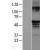 Western Blot: Estrogen Receptor beta Lysate [NBL1-10345] - Western Blot experiments. 
Left-Control; Right -Over-expression Lysate for ESR2